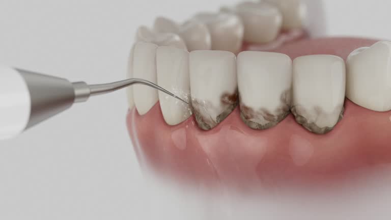 Trusted Tooth Extraction service in Blacklick Estates, OH - Dentist Open Now